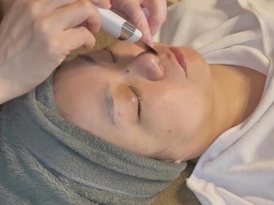 毛穴洗浄・角質ケアの施術の様子